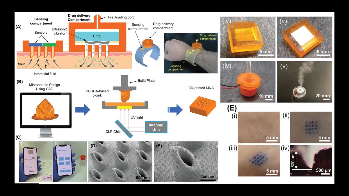 3D-Printed Microneedles Revolutionize Drug Delivery and Diagnostics