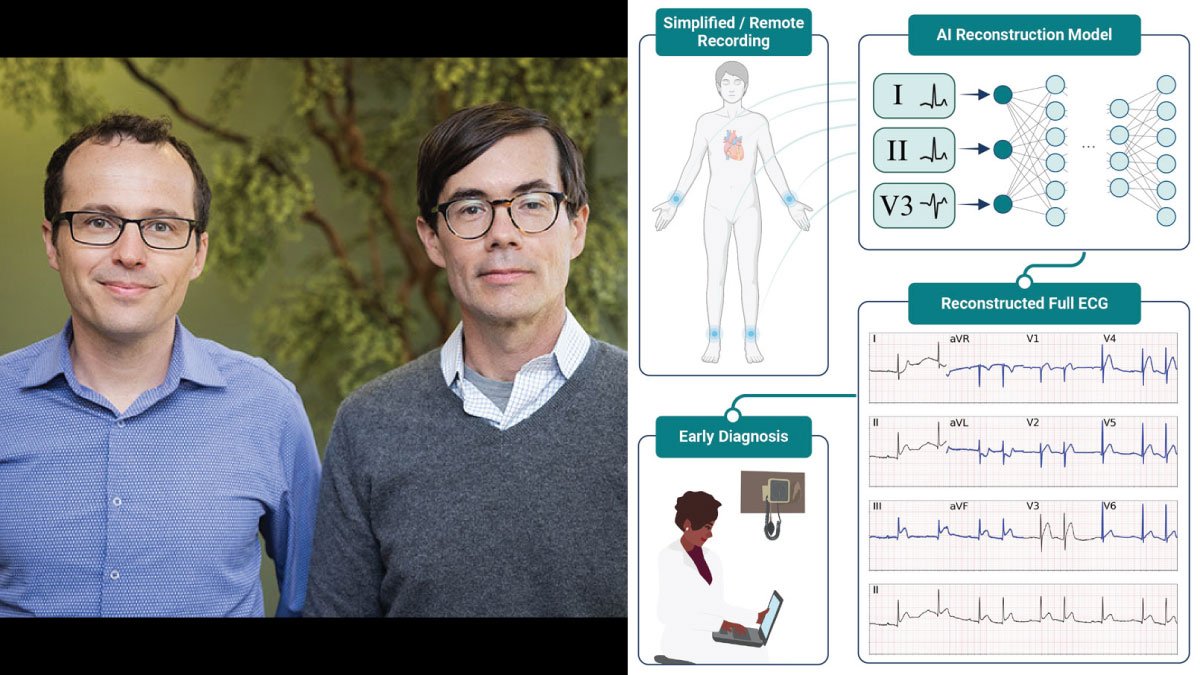 AI Heart Monitoring Tool Simplifies ECG with Fewer Leads