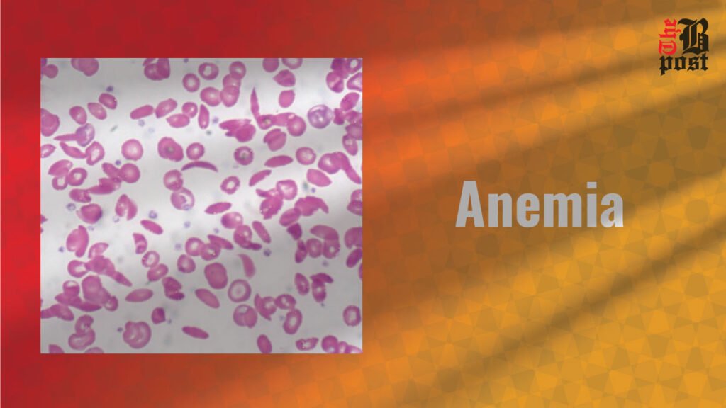 Anemia