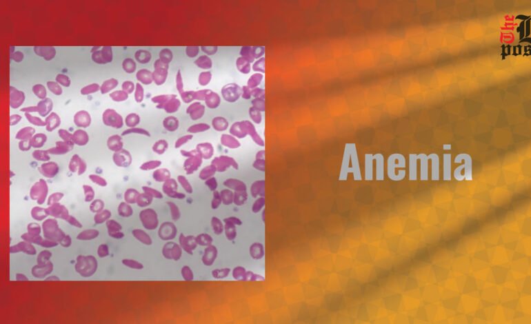 Anemia: Understanding Causes, Symptoms and Treatment