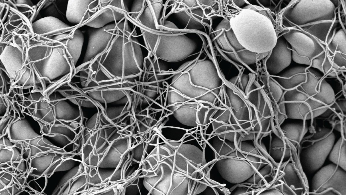 Artificial Platelets: A Lifesaving Breakthrough for Trauma Victims