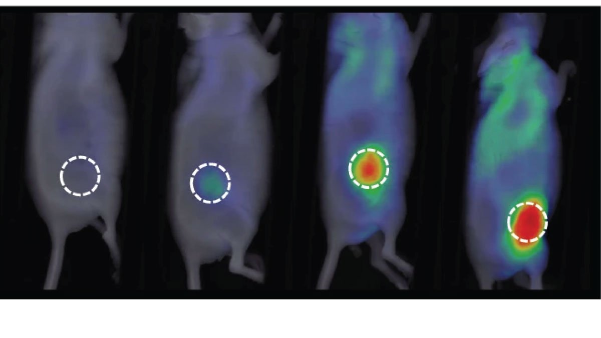 Histopathological Biomarkers for Nanomedicines Revolutionize Tumor Accumulation Prediction