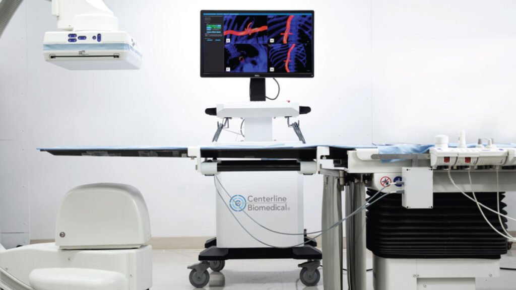 IOPS Viewpoint Catheter