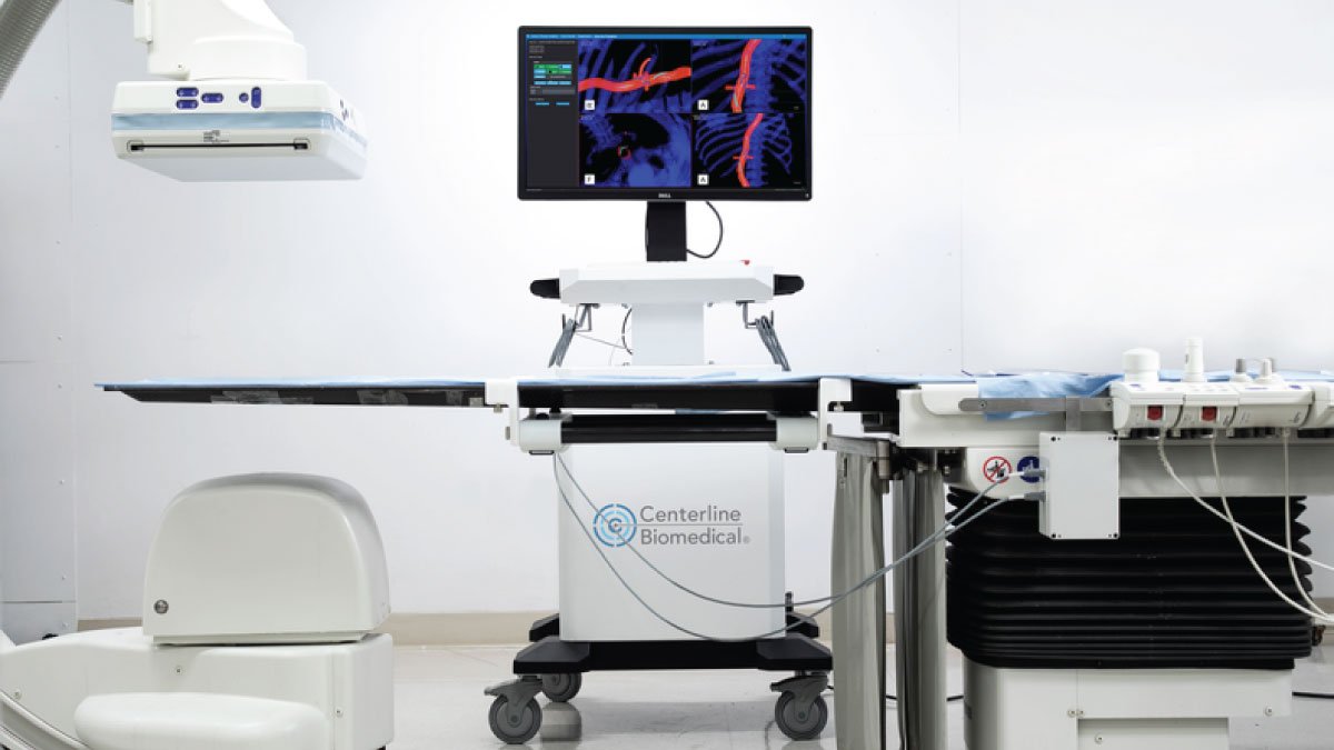 IOPS Viewpoint Catheter Gains FDA Clearance, Transforming Endovascular Surgery Safety