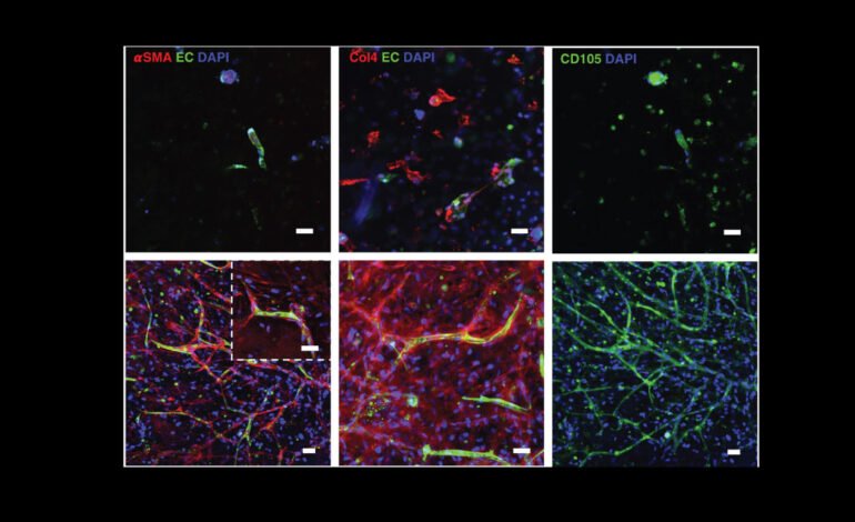 Immune Cells in Heart-on-a-Chip Pave the Way for Advanced Vascularization Technology