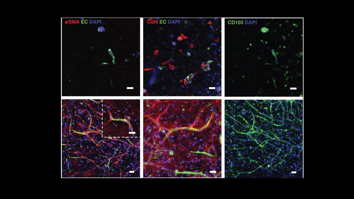 Immune Cells in Heart-on-a-Chip Pave the Way for Advanced Vascularization Technology