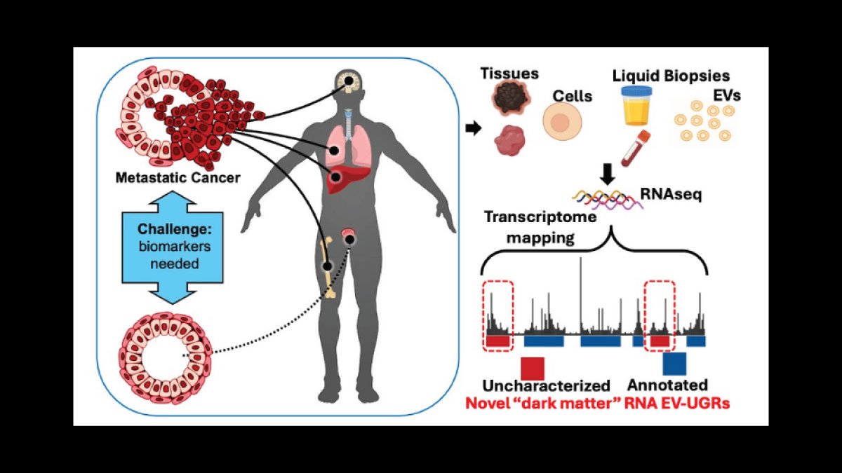 Nanoparticles in Blood: A Game-Changer for Cancer Diagnosis