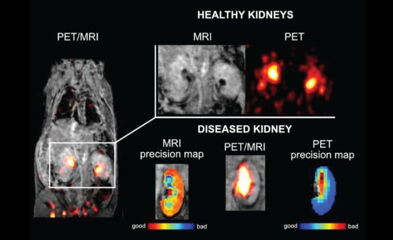 PET/MRI Probe by IOCB Prague Revolutionizes Early Detection of Hidden Diseases