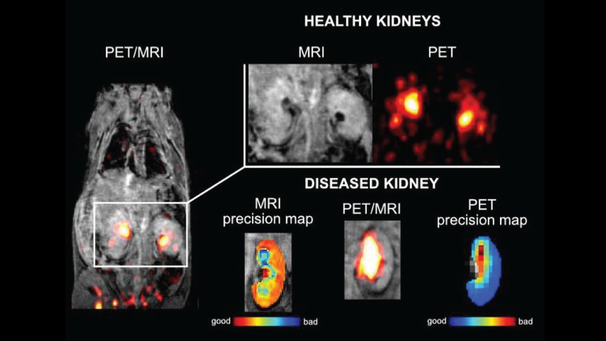 PET/MRI Probe by IOCB Prague Revolutionizes Early Detection of Hidden Diseases