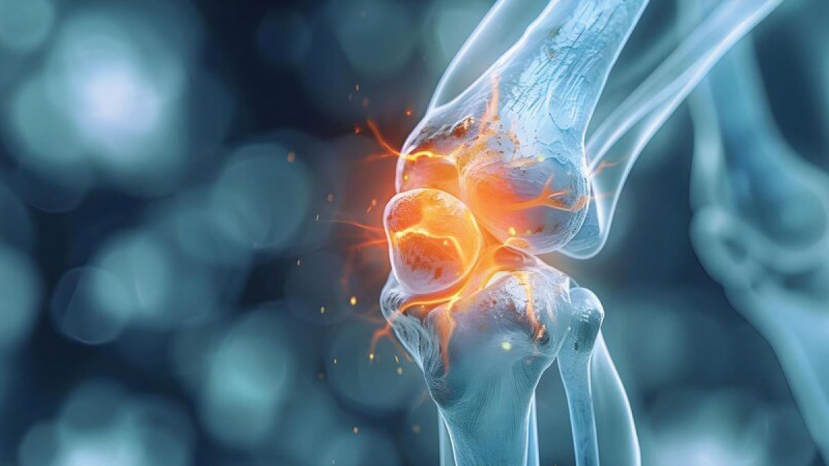 Stem Cell Therapy Poised to Revolutionize Osteoarthritis Treatment