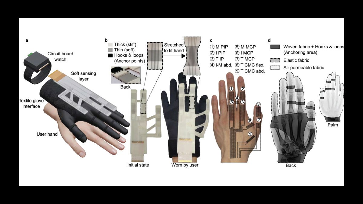 Stretchable Glove Technology to Transform Remote Surgical Robotics with Precise Hand Motion Detection