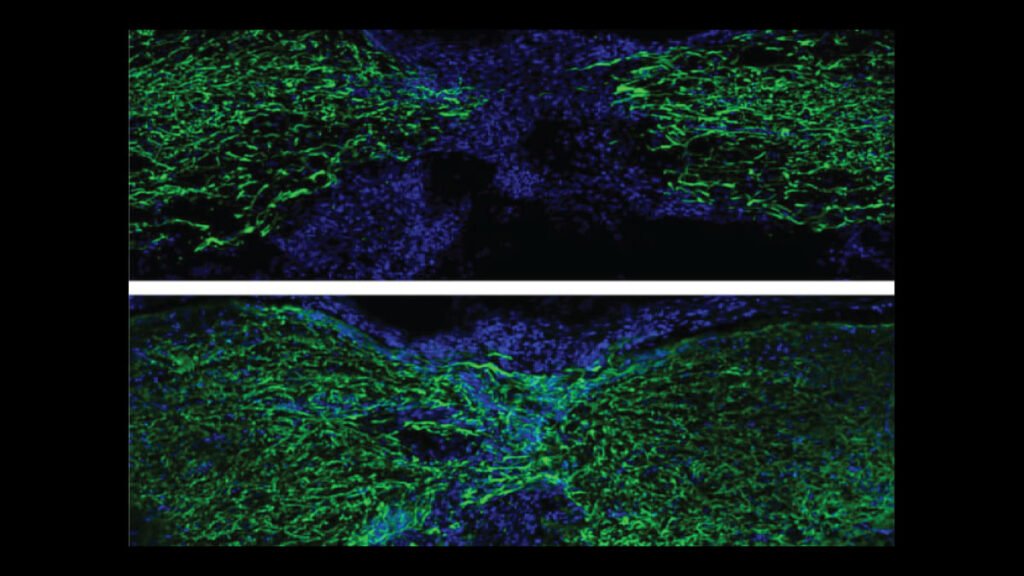 Zebrafish spinal cord regeneration