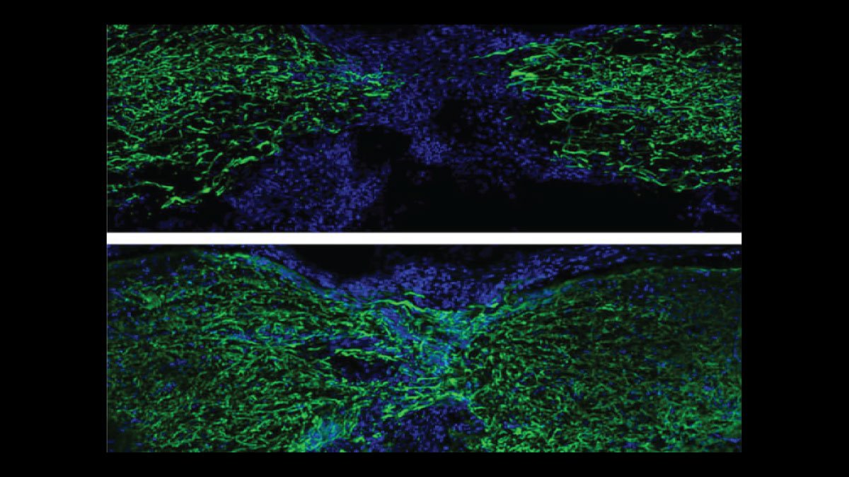 Zebrafish Spinal Cord Regeneration Unveils New Avenues for Medical Advances